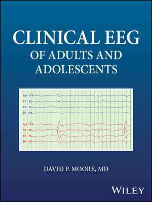 cover image of Clinical EEG of Adults and Adolescents